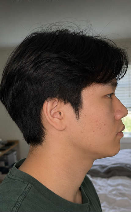 Before
