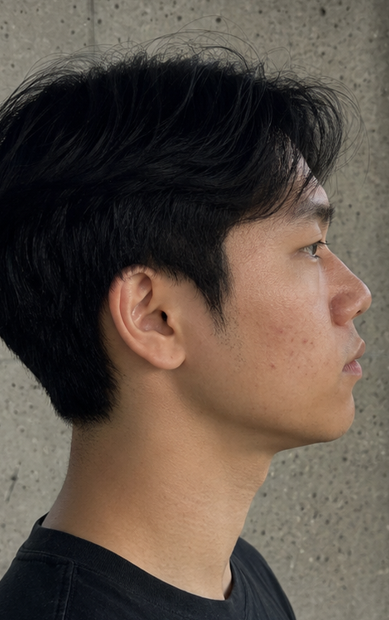 After